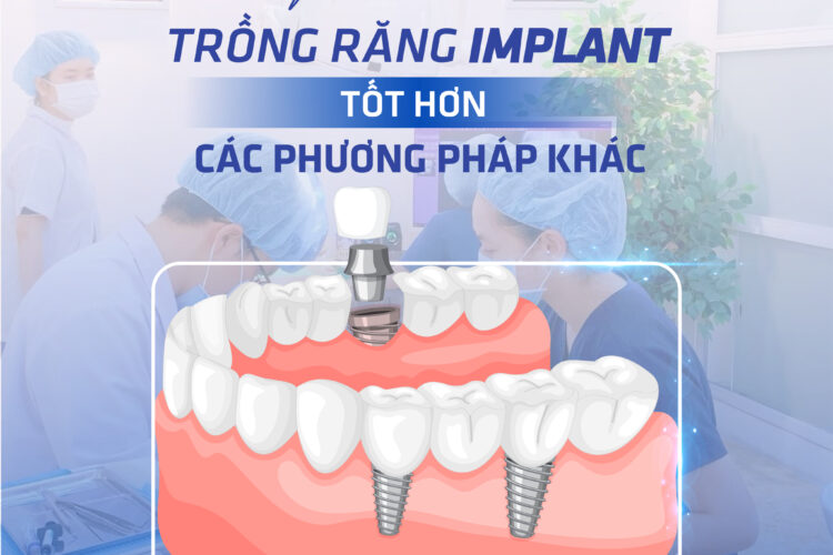 Why is dental implantation better than other dental restoration methods?