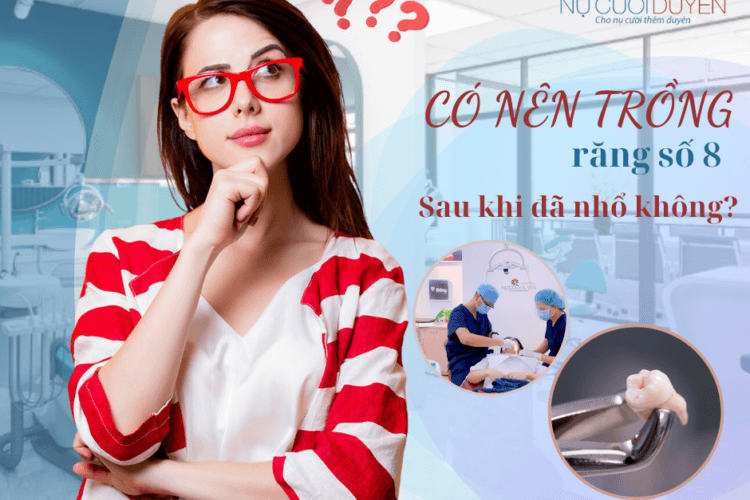 Có nên trồng răng số 8 sau khi đã nhổ không