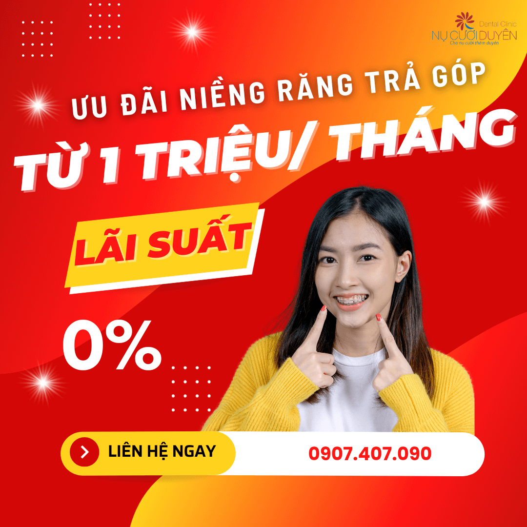 niềng răng trả góp