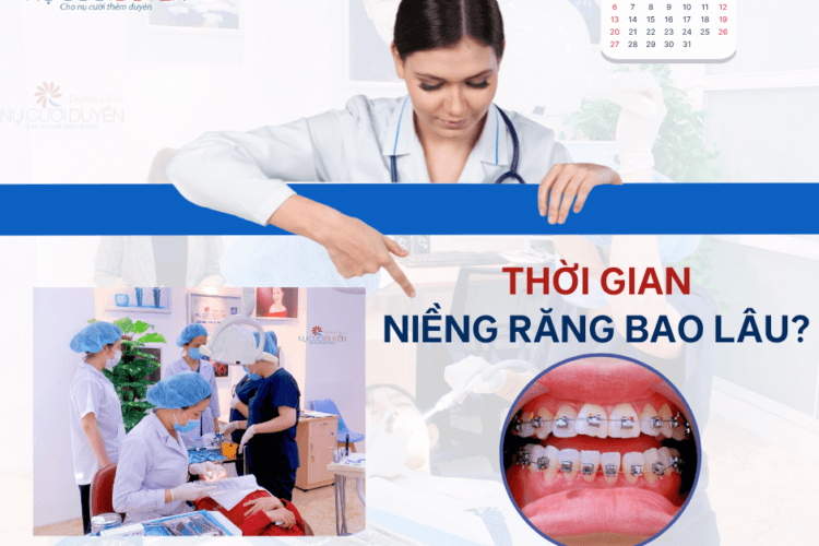 thời gian niềng răng