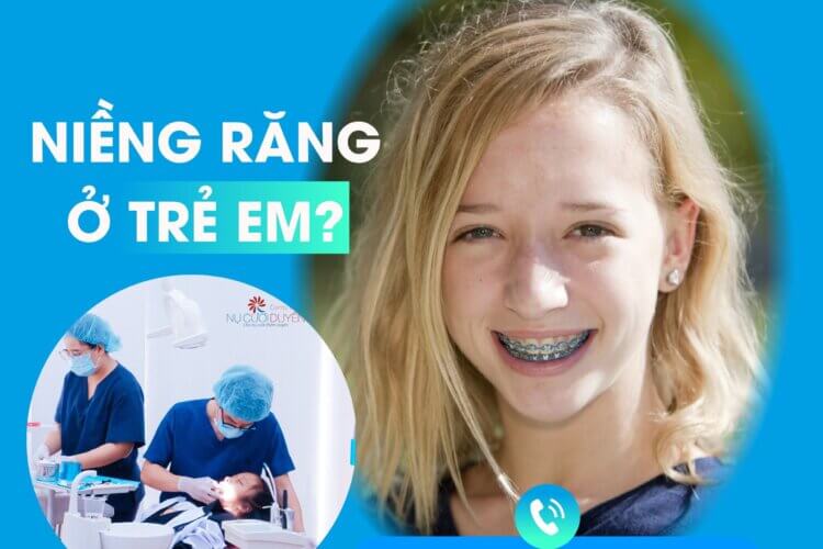 Trẻ em có niềng răng được không? Trẻ em nên niềng răng ở độ tuổi nào