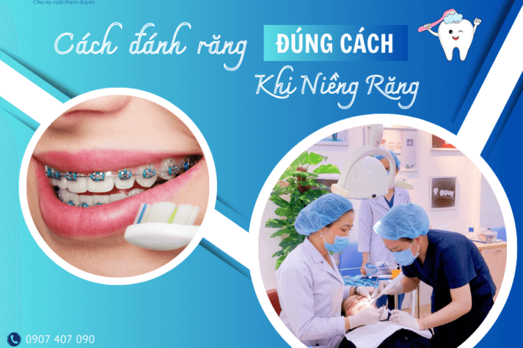 cách đánh răng đúng cách khi niềng răng