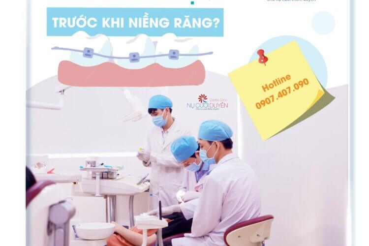 Cần chuẩn bị gì trước khi niềng răng? Nha khoa Nụ cười Duyên Bình Dương