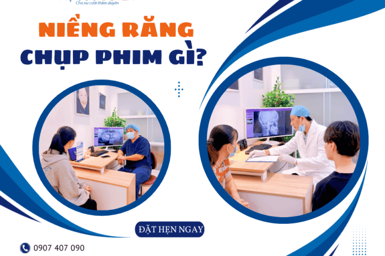 chụp phim niềng răng