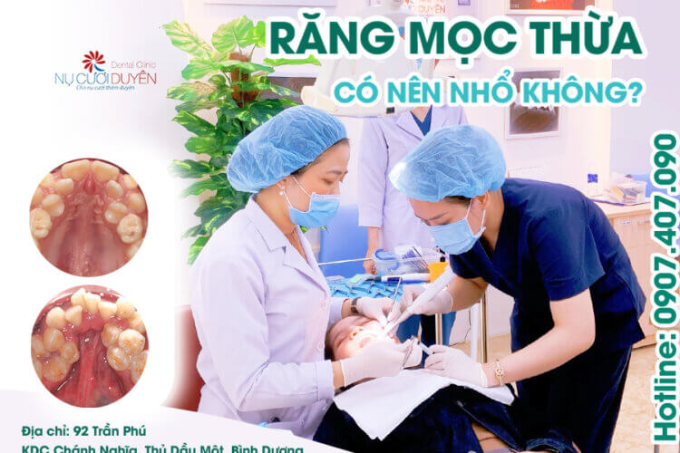 Mọc răng thừa có nên nhổ không - Nha khoa Nụ Cười Duyên