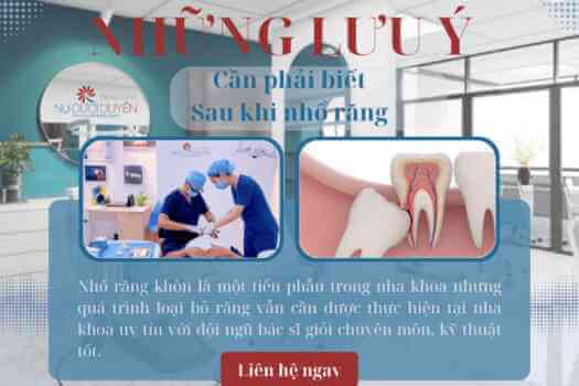 TOP 4 ĐIỀU NHỔ RĂNG KHÔN XONG CẦN PHẢI LƯU Ý