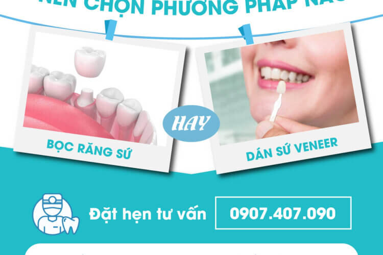 Nên bọc răng sứ hay dán sứ Veneer - Nha khoa Nụ Cười Duyên Bình Dương