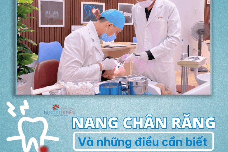 Nang chân răng và 6 điều cần biết