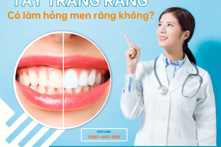 Tẩy trắng răng có làm hỏng men răng không?